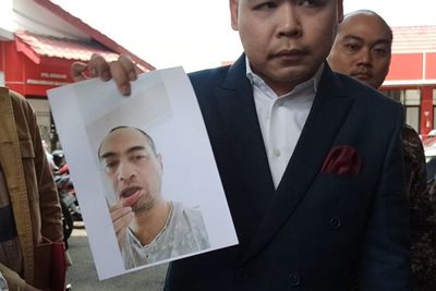 Makin Panas! Ferry Irawan Tunjukan Foto Bibirnya Berdarah Dicakar Venna Melinda