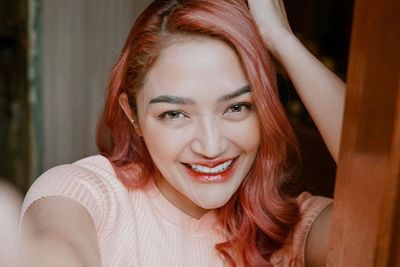 Disebut Operasi Plastik, Siti Badriah: Saya Punya Suami yang Merawat Saya dengan Baik