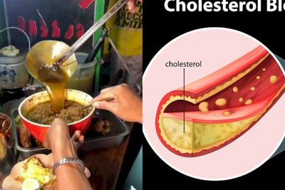Viral Kuliner Surabaya Nasi Minyak, Dokter Wanti-Wanti Risiko Penyakit Ini!