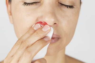 4 Obat Mimisan Alami untuk Anak dan Orang Dewasa, Paling Ampuh!
