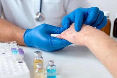 IDAI Ungkap Campak Berisiko Tingkatkan Infeksi karena Antibodi Turun