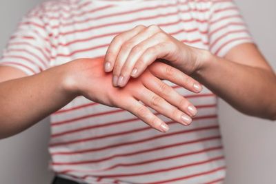 Carpal Tunnel Syndrome: Penyakit yang Paling Sering Diderita Gamer, Ini Cara Mencegahnya!
