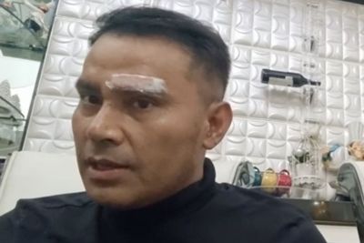 Main Sepak Bola, Pelipis Judika Robek sampai Dijahit