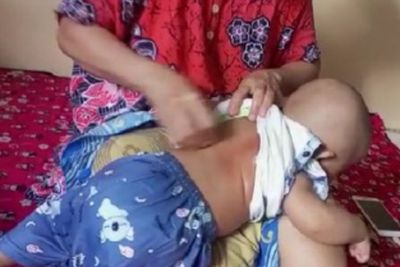 Viral Ibu Pamer Tubuh Anaknya Kerokan Sampai Merah, Netizen: Ibu-Ibu Sekarang Kenapa Sih