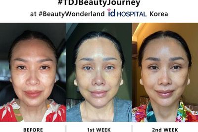 Deretan Artis Ini Oplas Wajah di Korea, Terbaru Titi DJ yang Menolak Tua di Usia 56 Tahun