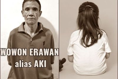Nasib Ayu, Anak Wowon Usia 5 Tahun yang Selamat dari Racun yang Kini Jalani Terapi