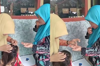 Viral Guru Makan Kutu Rambut Muridnya, Netizen Sebut Bisa Obati Hepatitis, Benarkah?