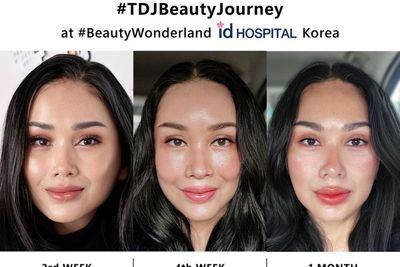 Menolak Tua, Titi DJ Pamer Wajah Hasil Oplas 1 Bulan, Gak Bengkak Lagi, Makin Tirus