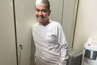 Jalani Operasi Mata, Indra Bekti Ditangani oleh Dokter Kepresidenan
