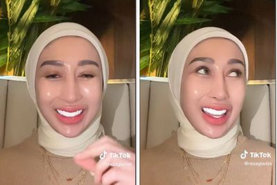 Gak Cuma Wajah Glowingnya, Netizen Juga Soroti Gigi Dokter Kecantikan Ini: Terang Banget!