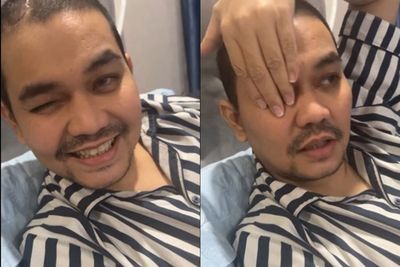 Indra Bekti Ngelihat Pakai Satu Mata Usai Operasi: Jelas tapi Masih Ada Airnya