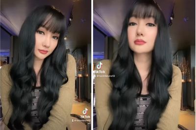 Lucinta Luna Pamer Wujud Hidung Baru Usai Oplas: Senggol Nih Boss!