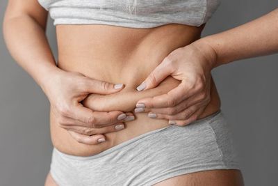Ganggu Penampilan, Bener Enggak Sih Stretch Mark Bisa Hilang Karena Diet?