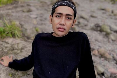 Kim Hwat Foto Tanpa Busana dan Kepala Botak untuk Penderita Kanker: Konsepnya Melenceng