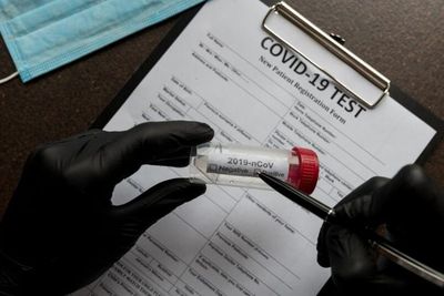 Kasus COVID-19 Indonesia Hari Ini Naik Lagi, Ada 272 Konfirmasi dan 4 Kematian