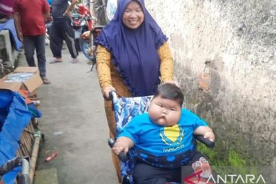 Menkes Budi akan Dampingi Balita Obesitas di Bekasi: Pasti Ada Sesuatu, Harus Dirawat!