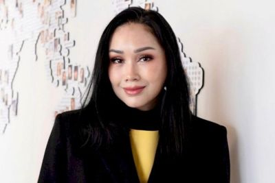 Bikin Ngilu! Titi DJ Ungkap Teknik Oplas Wajahnya Bukan Dijahit tapi Berbentuk Staples