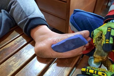 Viral Kaki Bocah Enggak Bisa Lepas dari Sandal Gara-gara Lem Korea, Damkar Turun Tangan