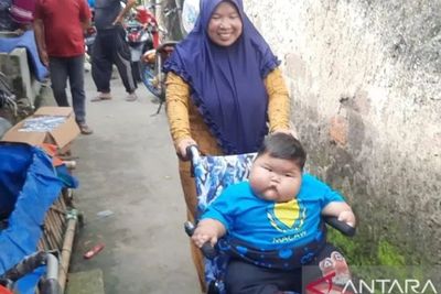 Viral Balita Obesitas 27 Kg di Bekasi, Dokter Gizi Soroti Pola Makan Keluarga