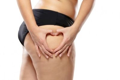 Cara Pudarkan Stretch Mark di Pantat Secara Alami, Simak Tipsnya!