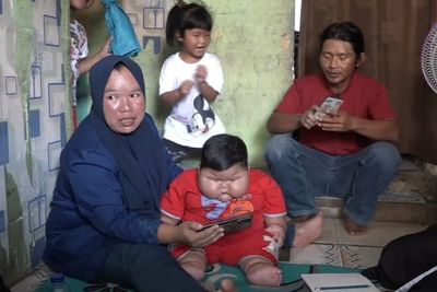 IDAI Curiga Balita Berbobot 27 Kg di Bekasi Idap Penyakit Obesitas Tak Biasa