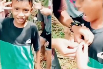 Berpose ke Kamera Padahal Lagi Pegang Kepiting, Tangan Bocah ini Berakhir Dicapit