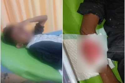 Bocah Kelas 6 SD Bacok Adik Kelas Pakai Celurit saat Main Bola, Sebabnya Saling Ejek