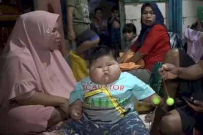 Kemenkes Ungkap Penyebab Bayi di Bekasi Punya Berat Badan 27 Kg, Ternyata Kelainan Genetik