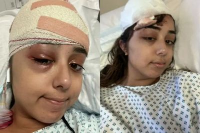 Jeena Panesar, Wanita yang Alami Kecelakaan hingga Jepit Rambutnya Tertancap di Kepala