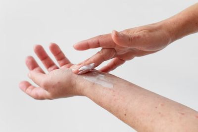 Miliki Kulit Eksim Gatal dan Ruam Merah? Kandungan di Skincare Ini Bisa Mencegahnya!