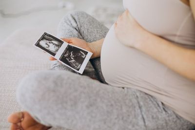 Waspada! Ibu Hamil yang Positif COVID-19 Berisiko Sebabkan Gangguan Otak pada Bayi