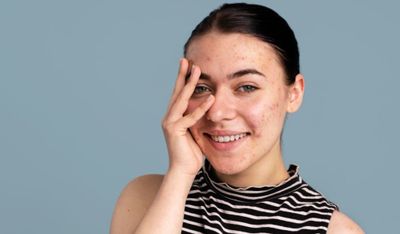 Punya Kulit Sensitif, Iritasi dan Kemerahan? Begini Cara Pakai Skincare-nya!