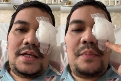 Indra Bekti Jalani Operasi Mata Lagi: Gak Berasa Apa-apa