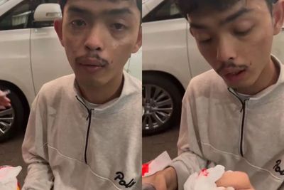 Viral Pemuda Ditonjok Driver Ojol Sampai Berdarah, Pihak Gojek Minta Maaf 