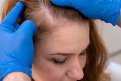 Polusi Udara Picu Kerusakan Rambut, Begini Cara Mengatasinya 