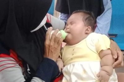 Raisya, Bayi Obesitas Berbobot 15 Kg Mengalami Gangguan Syaraf dan Sulit Beraktivitas