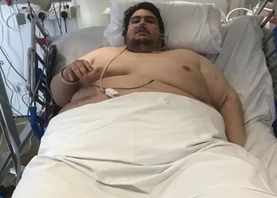Pria Ini Gak Yakin Bisa Hidup Lebih dari 2 Tahun karena Beratnya 300 Kg, Bisa Konsumsi 10.000 Kalori Sehari