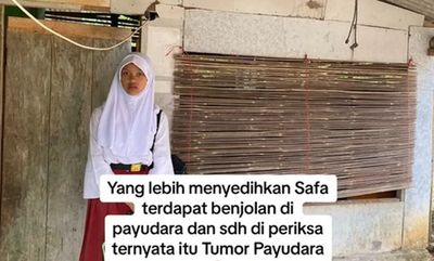 Jadi Yatim Piatu, Sekarang Siswi SD Ini Berjuang Lawan Tumor Payudara