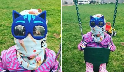 Gadis Kecil Ini Derita Penyakit Langka Mirip Vampir, Gak Bisa Harus Terpapar Sinar Matahari