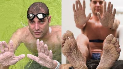 Kisah Inspiratif Penyintas Leukimia Pecahkan Rekor Berenang 45 Jam untuk Amal Kanker
