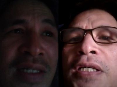 Kisah Tragis Ricard Siagian yang Tak Tidur Selama Satu Tahun, Rela Kehilangan Kaki Demi Tidur 3 Jam