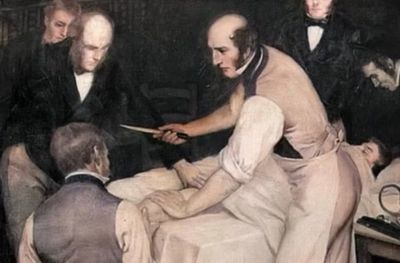 Kisah Dokter Bedah di London Melakukan Operasi Secepat Kilat agar Pasien Merasakan Sakit hanya Sebentar