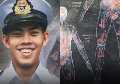 Tragedi Taruna AL yang Tubuhnya Disetrika 90 Kali hingga Berakhir Tak Bernyawa
