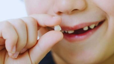 5 Arti Mimpi Gigi Copot Semua Menurut Primbon Jawa, Pertanda Buruk?