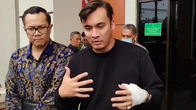 Rendy Kjaernett Bantah Lady Nayoan Patah Tulang Akibat Kecelakaan: Gak Usah Dikhawatirkan!