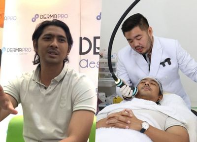 Untuk Jaga Ketampanan, Arya Saloka Jalani Treatment Onda Pro