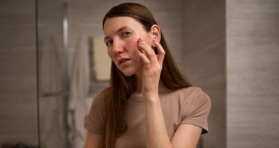 5 Kandungan Skincare Ini Efektif dan Aman untuk Kulit Sensitif