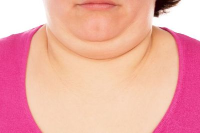 Cara Alami Hilangkan Double Chin: Solusi Praktis untuk Wajah Ideal