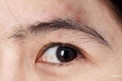 Apa Arti Jerawat di Alis bagi Kehidupan Cinta Kamu? Mitos atau Fakta