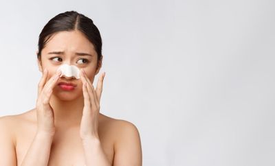 Kenali Perbedaan Komedo dan Sebaceous Filament serta Cara Menghilangkannya